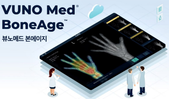 골연령 AI 판독시스템